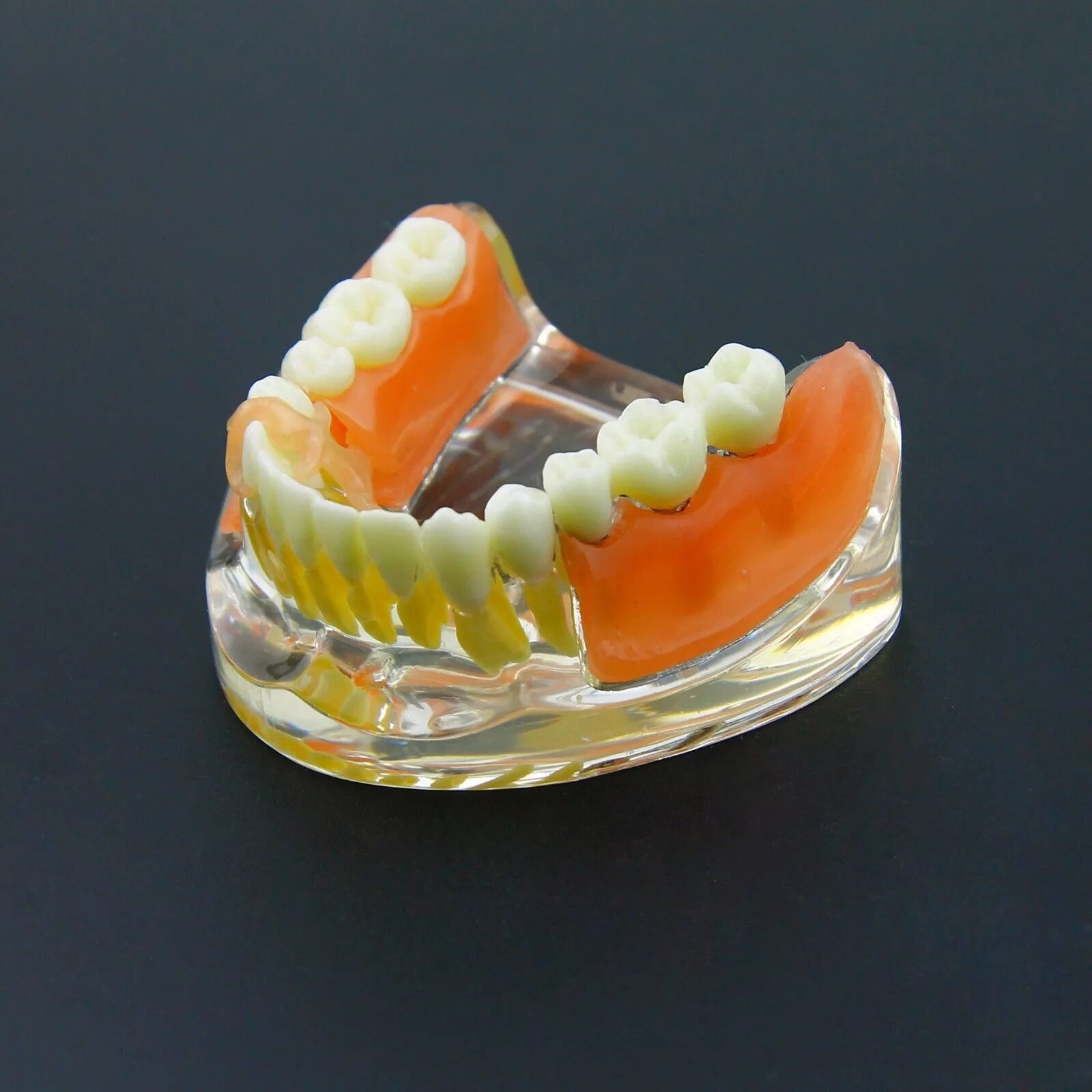 Зубные протезы нового поколения цена. Съемный протез (3-5 зубов) термо Джет. Нейлоновый протез зубной бюгельный. Нейлоновый микропротез 1-3.