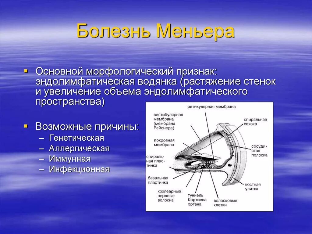 Синдром миньера что это