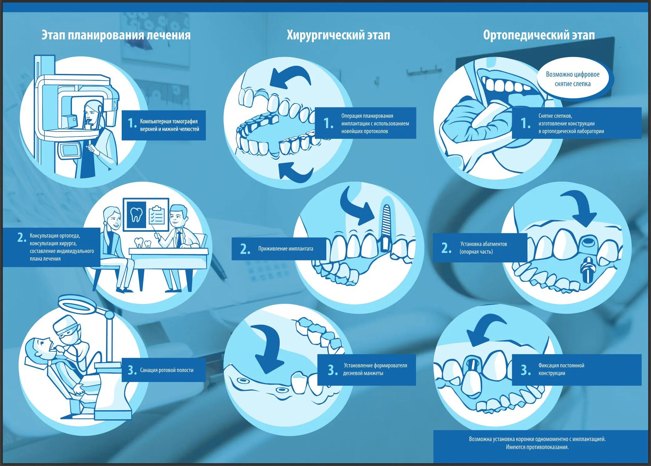 Планирование дентальной имплантации. Планирование ортопедического лечения. Этапы планирования имплантации. Этапы имплантации зубов. Ортопедический этап лечения