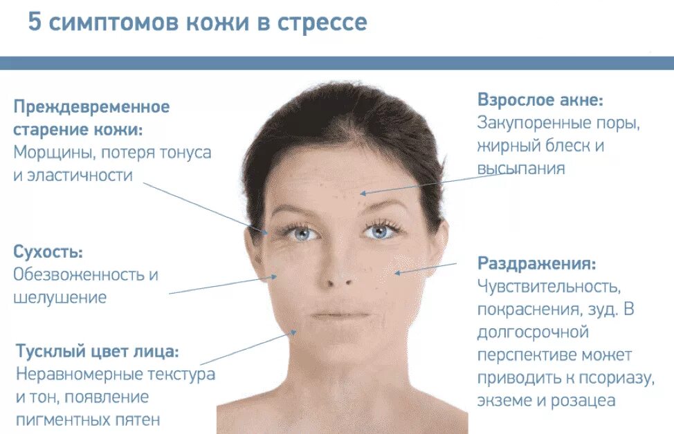 Влияние стресса на кожу лица. Симптомы стресса на лице. Проявления старения кожи.