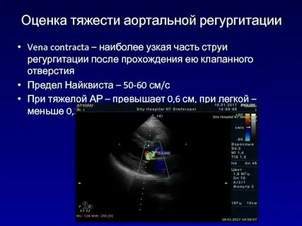 Пульмональная регургитация 1 степени что это такое
