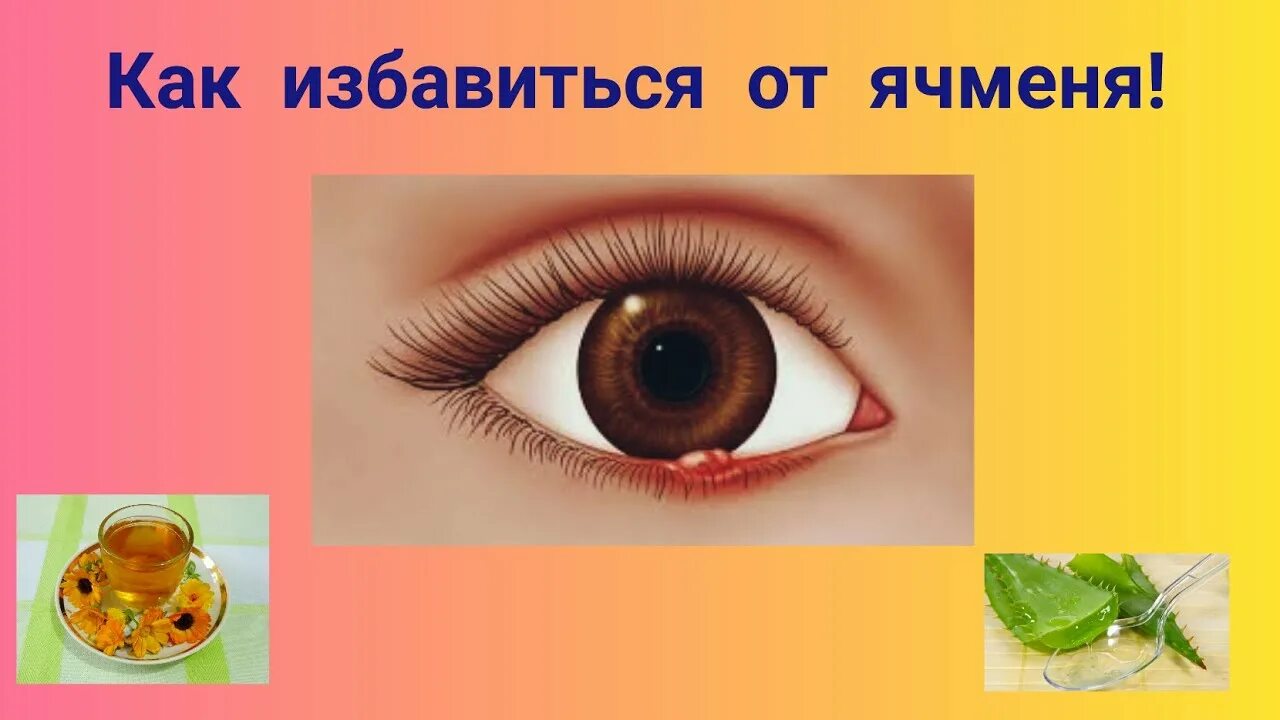 Народное лечение ячменя у взрослых. Как выглядит ячмень на глазу. Как избавица АТ ячминя.