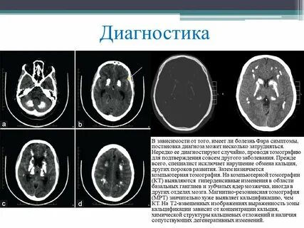 Диагностика зависимости
