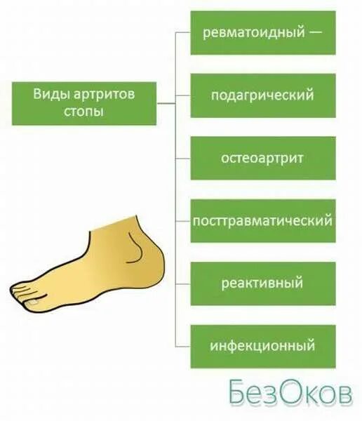 Виды ревматоидного артрита. Ревматоидный артрит типы. Виды ревматических артритов. Типы артритов