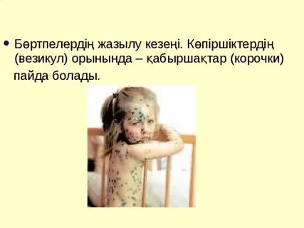 Сүндетсіз жалаңаш бас