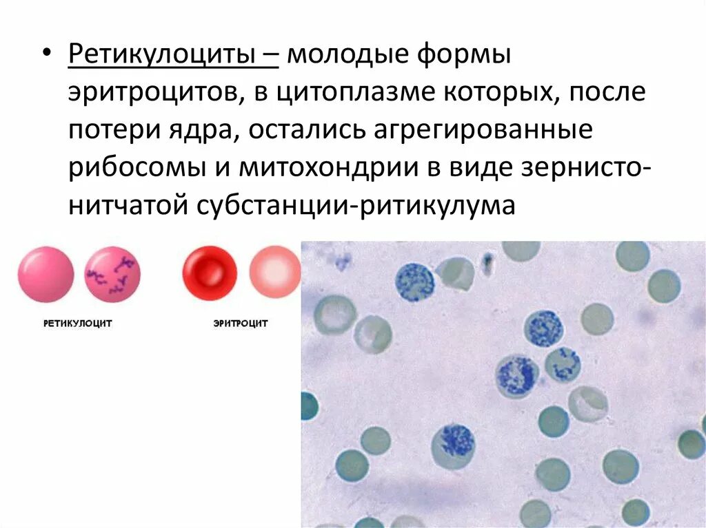 Цитоплазма эритроцитов человека. Ретикулоциты 1.9. Схема эритропоэза ретикулоциты. Ретикулоциты бланк. Ретикулоциты 100.