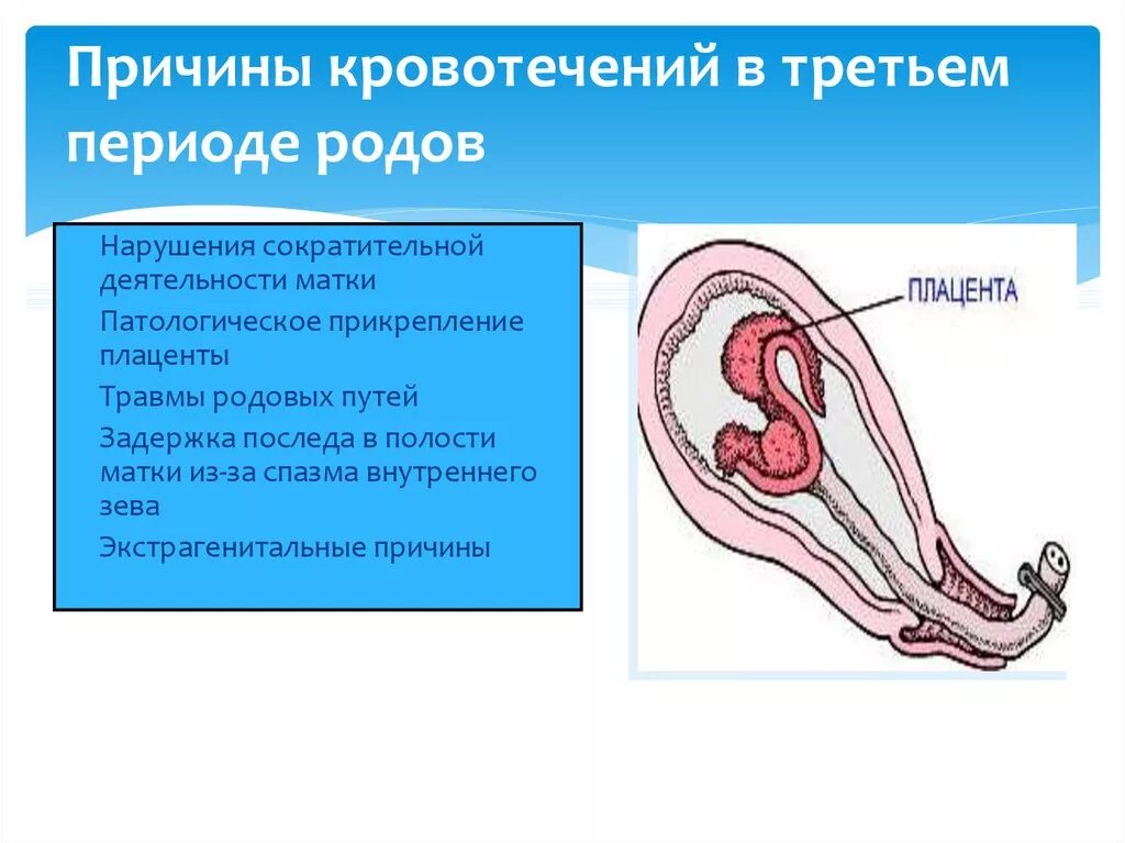 Причины кровотечения в 3 периоде родов. Кровотечения в родах и послеродовом периоде. Причины кровотечения третый прериод родый.