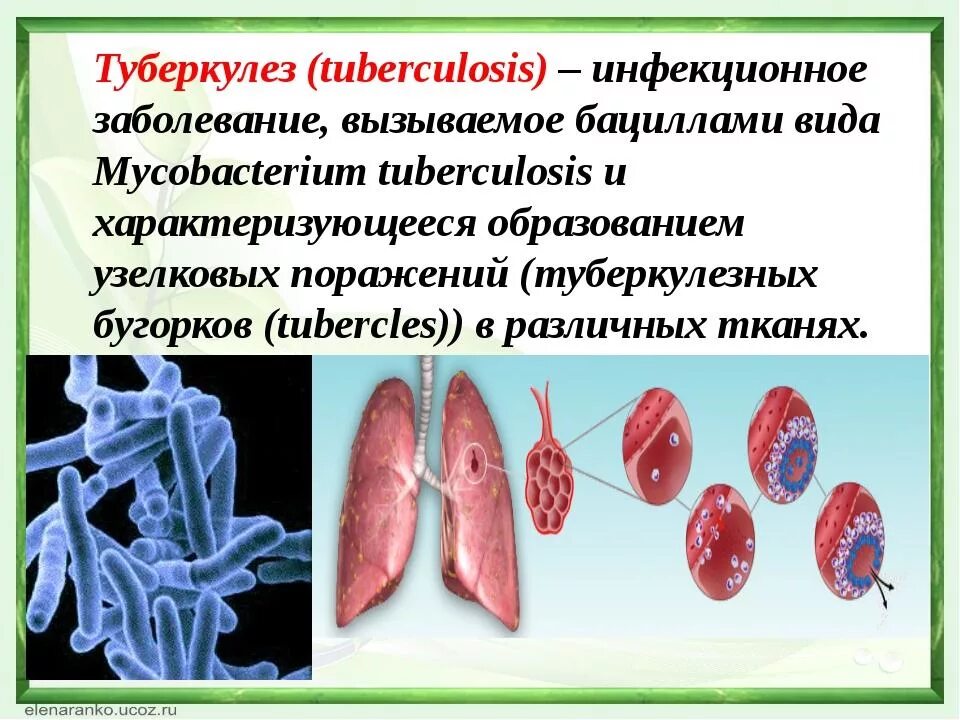 Туберкулез это. Туберкулез это инфекционное заболевание. Презентация на тему туберкулез.
