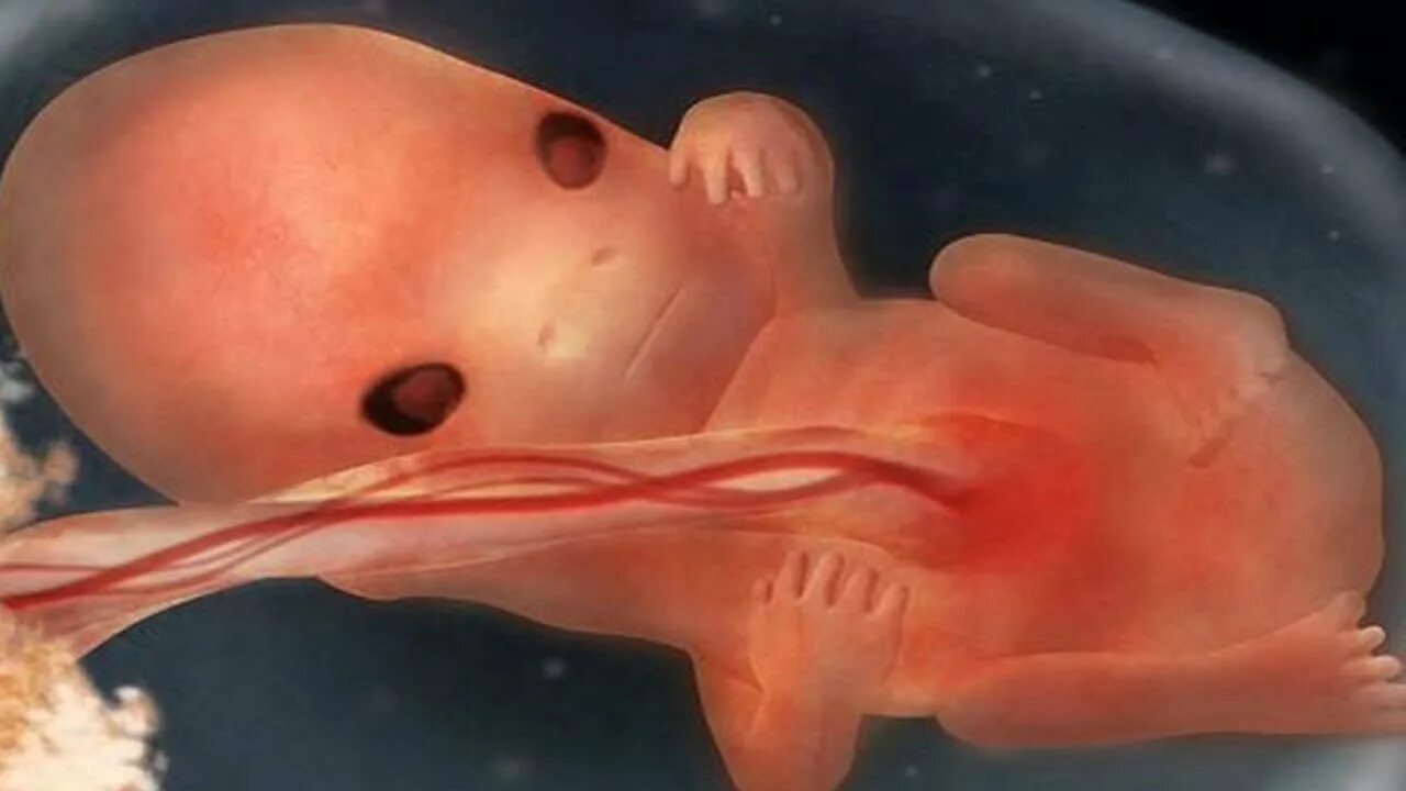 Кровь на 9 неделе. Эмбрион на 9 акушерской неделе. 9-10 Недель беременности фото плода. 10 Недель беременности фото плода. Плод ребенка в 9 недель беременности фото.