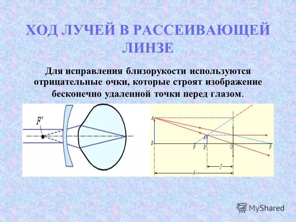 Оптическая линза назначение