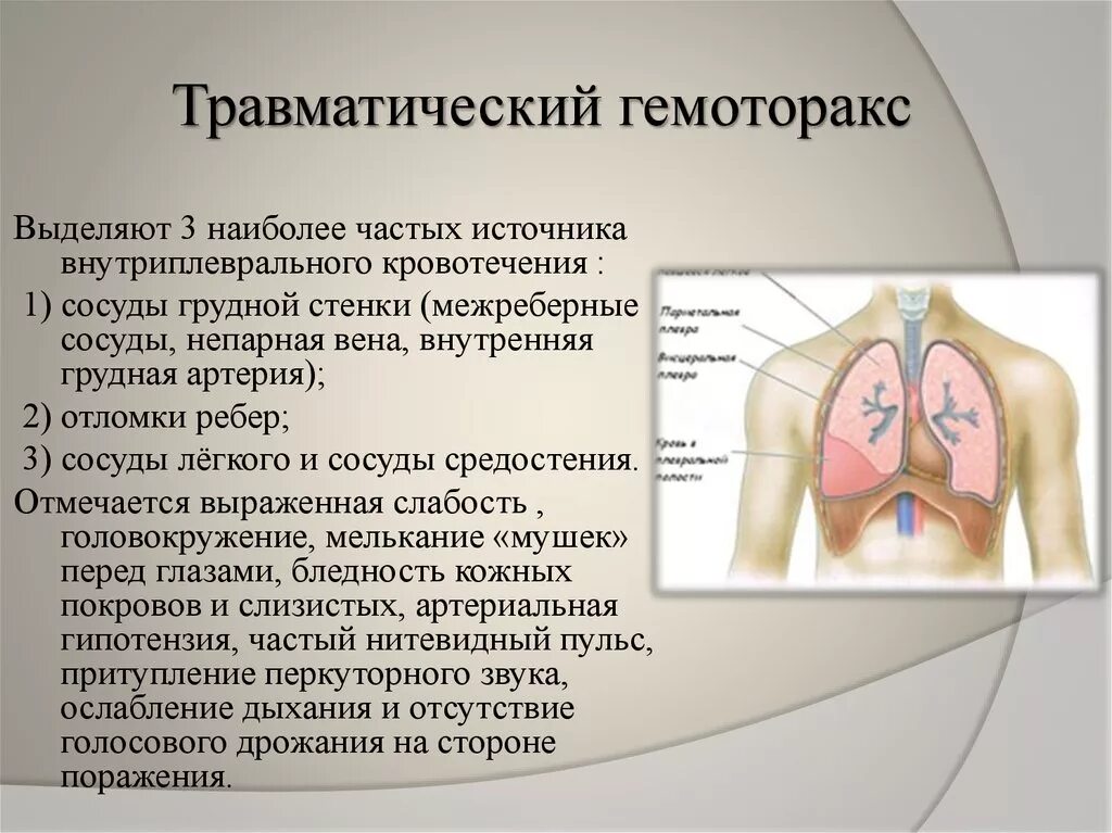 Кровотечение груди. Повреждение грудной клетки гемоторакс. Посттравматический гемоторакс. Гимноторакс. Кровотечение в плевральную полость.