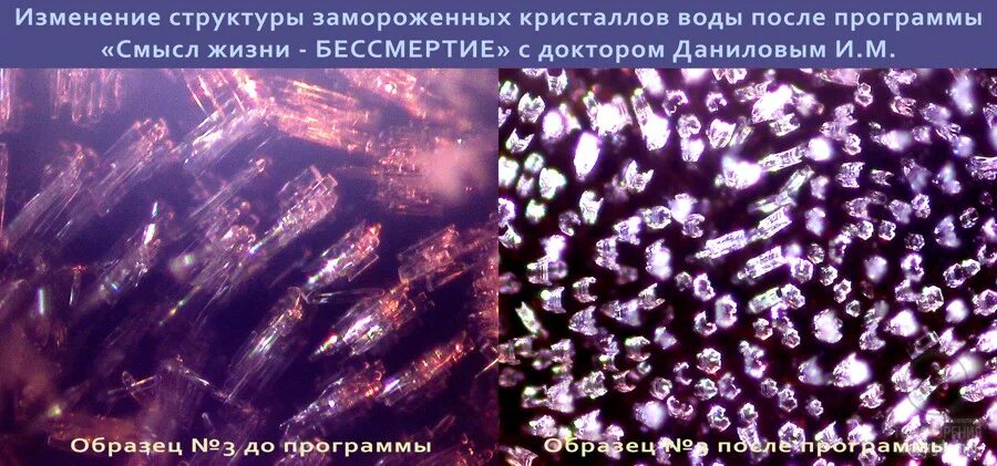 Структура воды под микроскопом. Изменение структуры воды. Вода под микроскопом. Кристаллы воды под микроскопом.