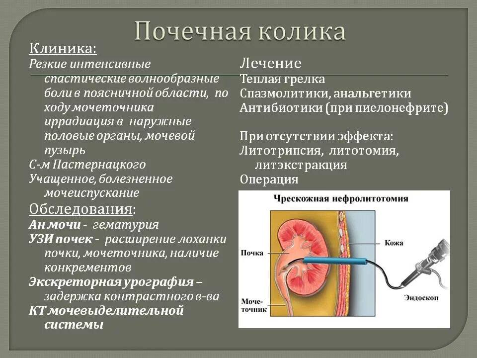 Болезненное мочеиспускание причины. Почечная колика. Причины развития почечной колики. Проявления почечной колики. Основные клинические симптомы почечной колики:.