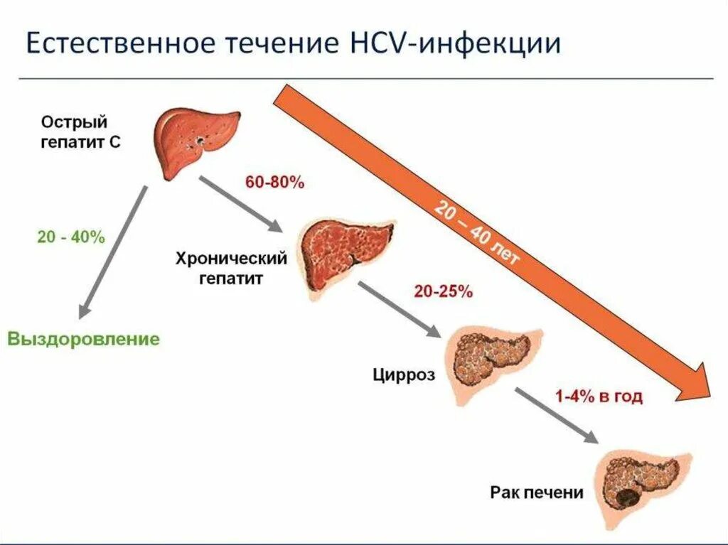 Хроническая болезнь печени. Острый и хронический гепатит.