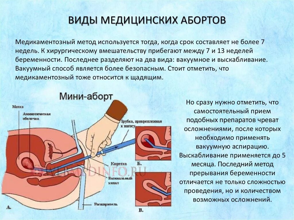 Методика выполнения аборта. Вакуум аспирация аборт. Методика медицинского аборта. Хирургические методы прерывания беременности. После вакуумный аспирация форум