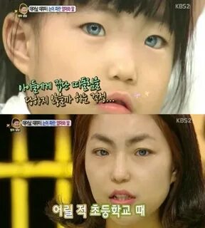 Idols eye