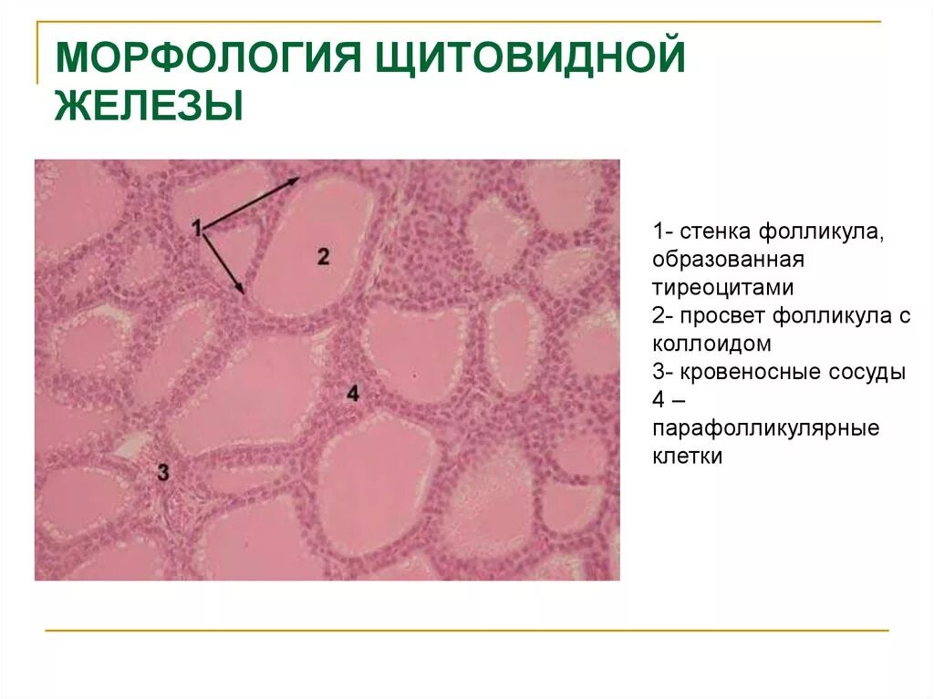 Щитовидная железа гистология препарат. Эпителий фолликулов щитовидной железы. Строение фолликула щитовидной железы гистология. Парафолликулярные клетки щитовидной железы препарат.