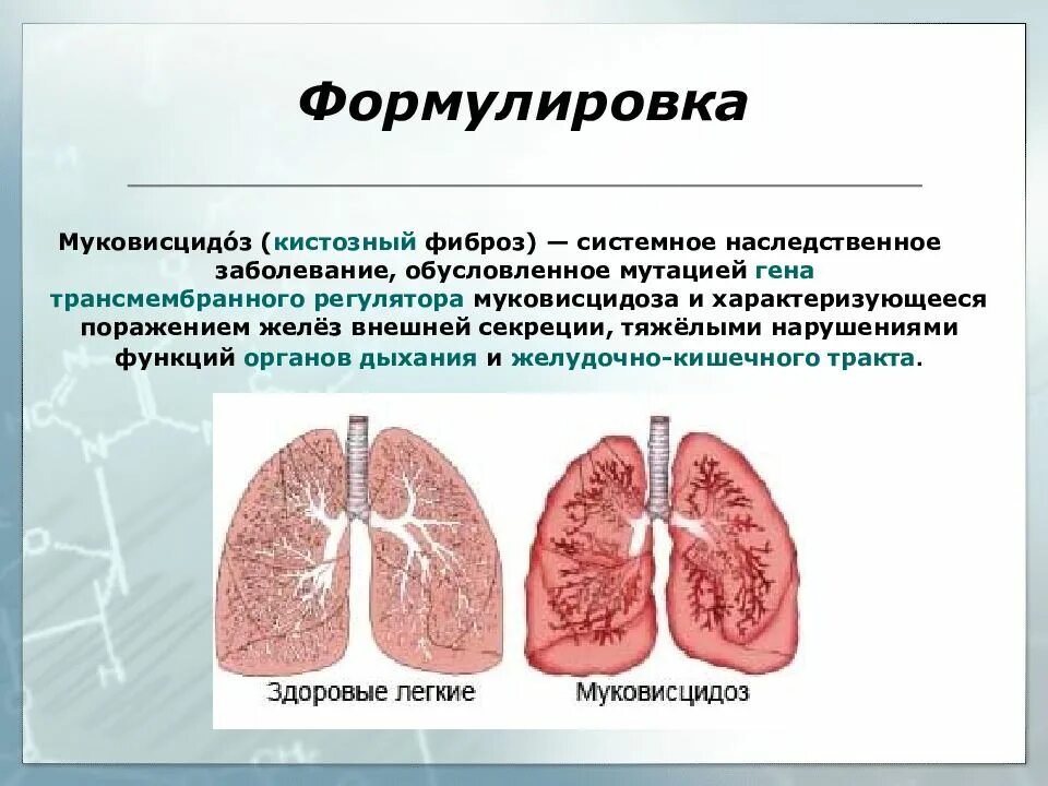 Сколько живут с фиброзом. Патогенез лёгочной формы муковисцидоз. Наследственное заболевание муковисцидоз. Муковисцидоз (кистозный фиброз).
