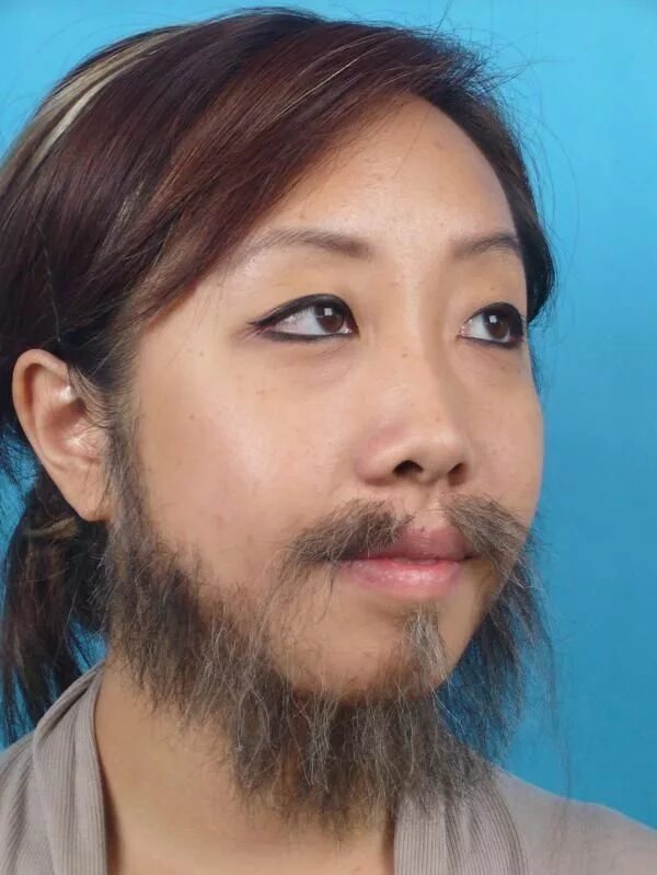 Волосатый азиат. Женщина с усами. Женщина с бородой. Женщина с усами и бородой. Усатая девушка.