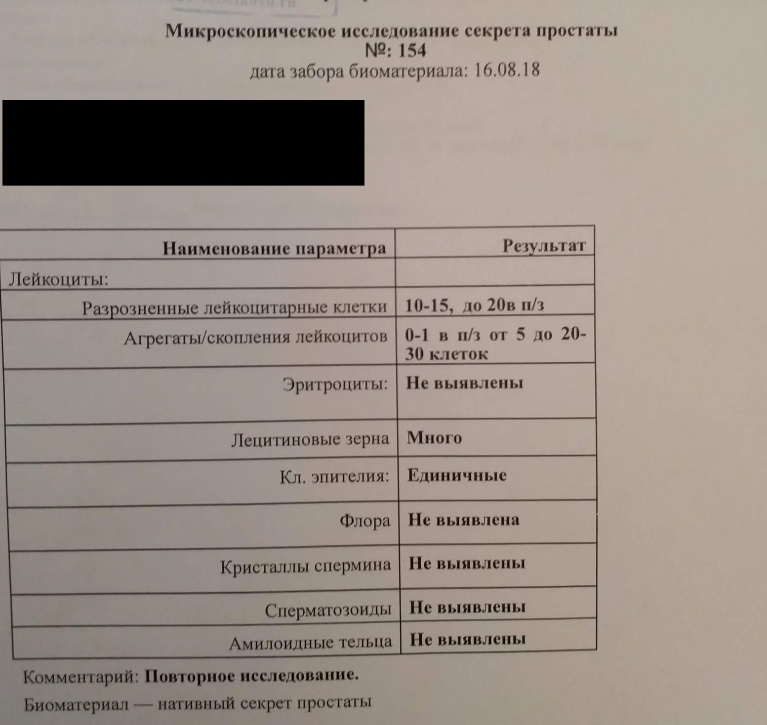 Анализ простаты у мужчин как называется. Секрет простаты анализ. Микроскопическое исследование секрета простаты. Сок простаты анализ. Микроскопическое исследование осадка секрета простаты.