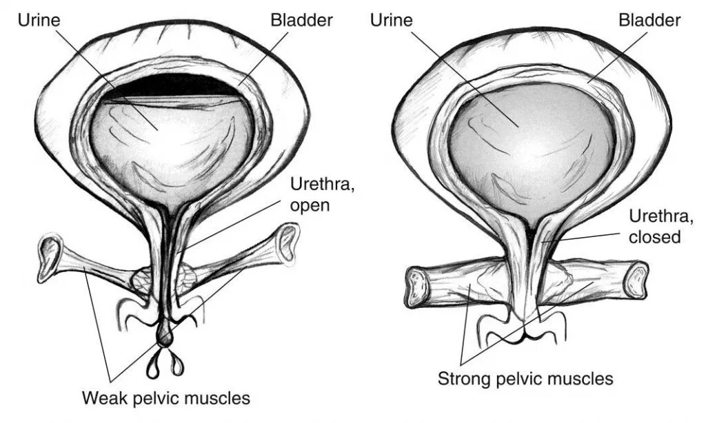 После мочевого. Мочевое недержание. Схема мочевого пузыря у мужчин. Мочевой пузырь анатомия. Анатомия мочевого пузыря у женщин схема.