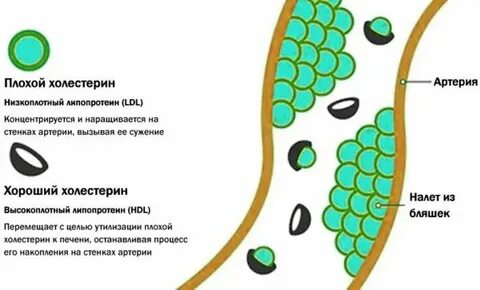 Какой холестерин считается плохим
