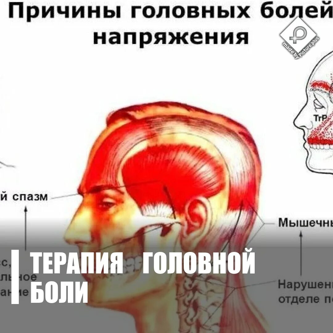 Головная боль обручем. Головные боли сдавливание головы. Сжимающая боль в голове. Сдавливание головы причины.