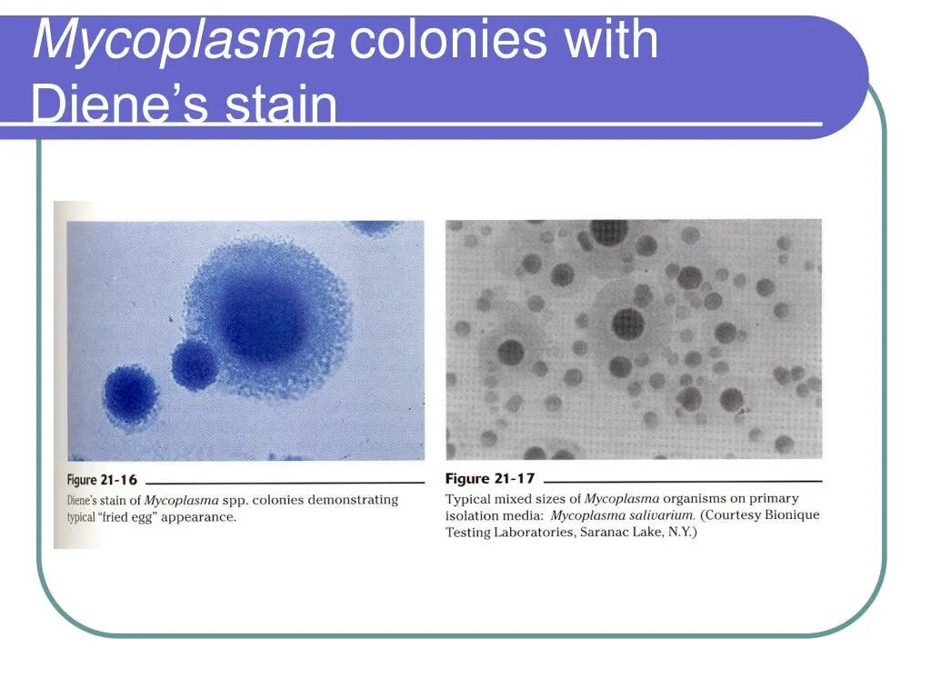 Пролин у микоплазм. Микоплазмы строение микробиология. mycoplasma pneumoniae микробиология. микоплазмы микробиология морфология. микоплазма строение мембраны.