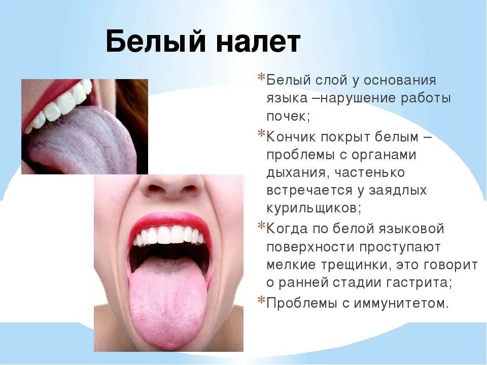 Противосудорожные препараты при судорогах в ногах. Гипопластический глоссит. Лихеноидный десквамативный глоссит. Воспаление полости рта под языком. Почему сводит язык.