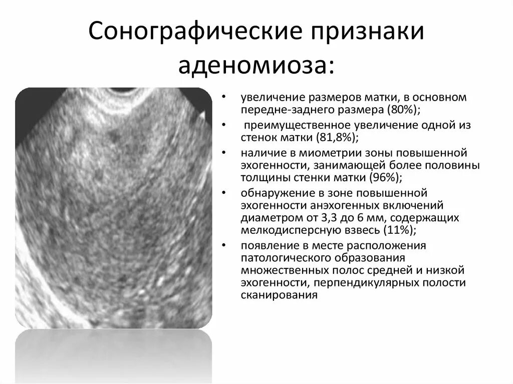 Миометрий диффузно неоднородный эндометриоз. Внутренний эндометриоз признаки УЗИ. Аденомиоз Узловая форма УЗИ. Внутренний эндометриоз Узловая форма. Структурные изменения матки