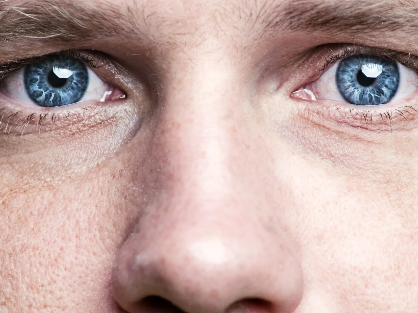 Лицо наполовину. Пигментация вокруг глаз. Images eye skin. Темн круги под глазами. Магнитные глаза.