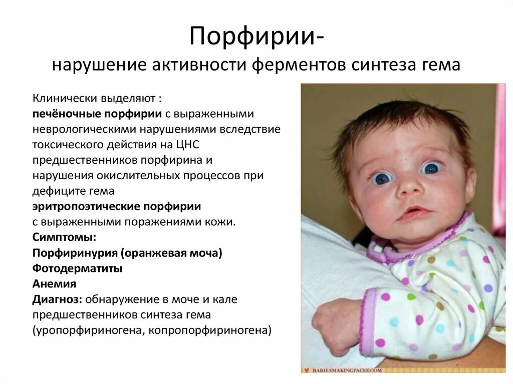 Острая перемежающаяся порфирия: симптомы, диагностика, лечение