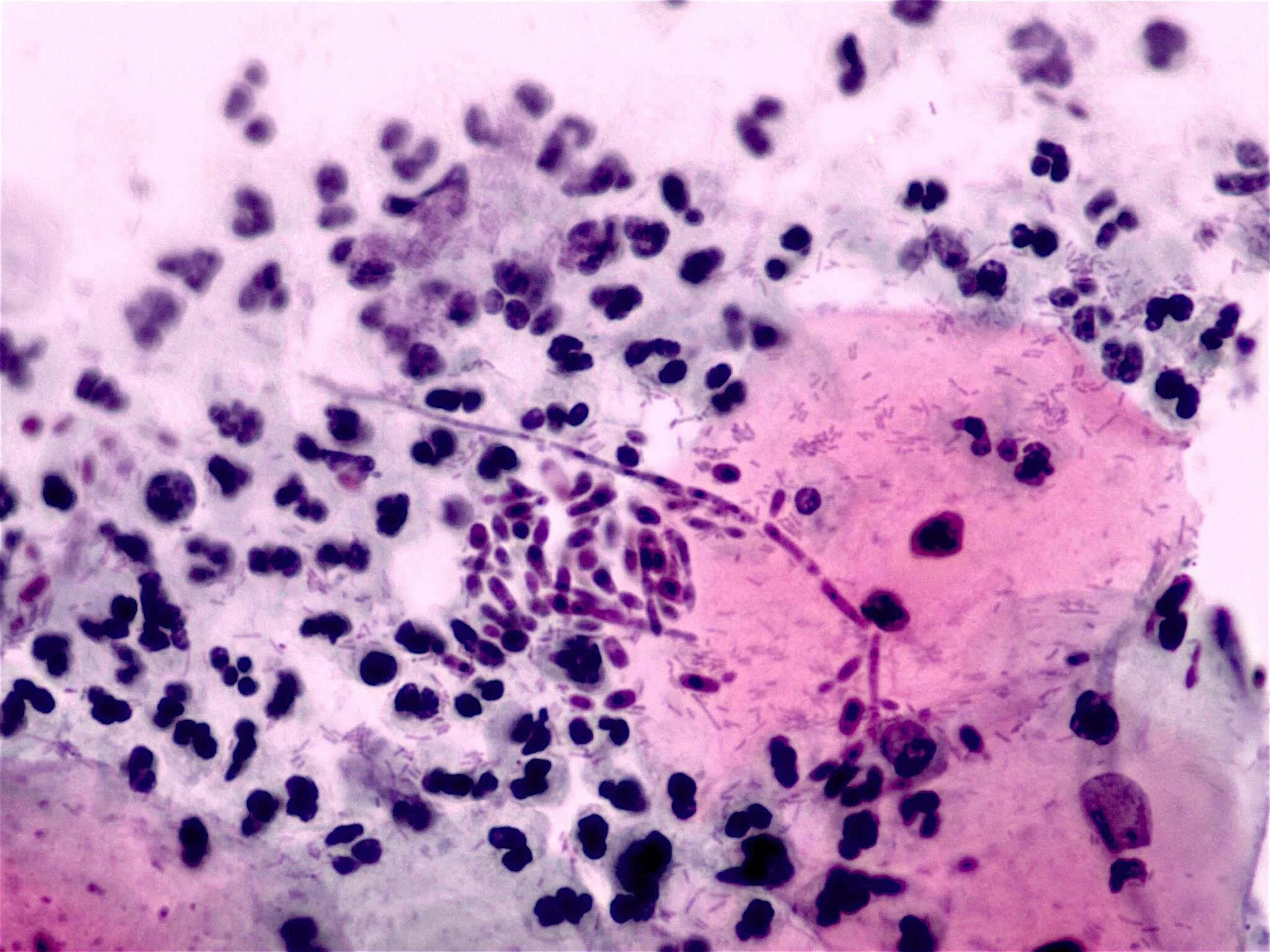 Дрожжеподобные грибы candida. Грибы кандида микроскопия. Урогенитальный кандидоз микроскопия. Грибок кандида под микроскопом.
