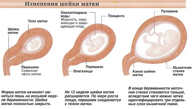 Можно ли забеременеть без маточных