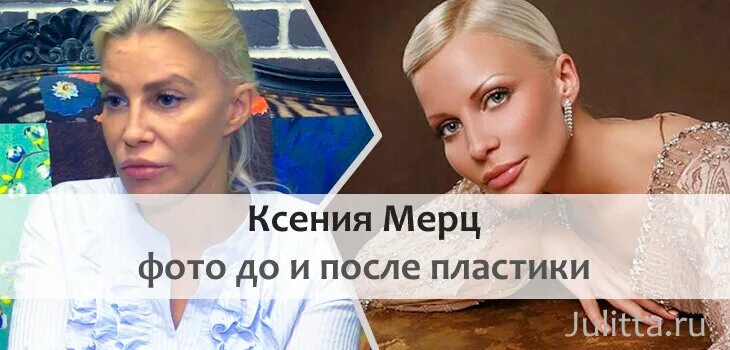 Ксения Мерц фото, инстаграм, какими соцсетями пользуется? Фото до пластики?
