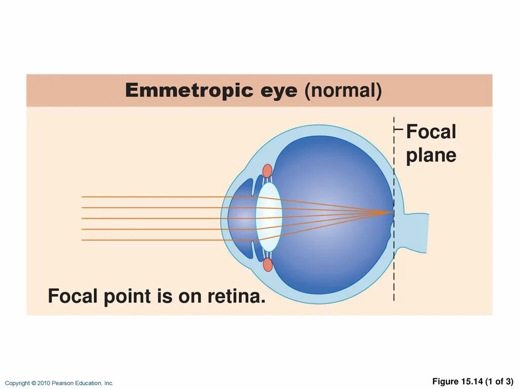 Eye point. Emmetropic eyes. focal point. focal plane. focal point 30g.