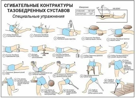 Упражнения после операции шейки бедра