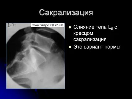 Сакрализация это