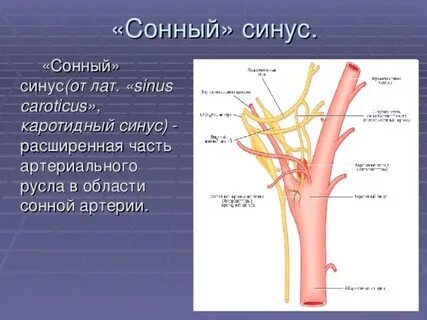 Каротидный синус