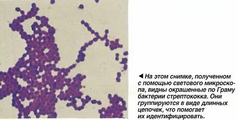 Стрептококк у новорожденных