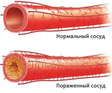 Вен вен отзывы