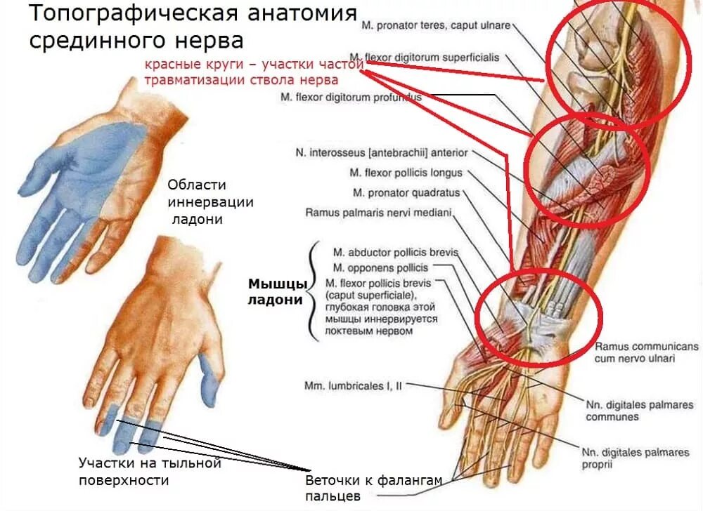Туннельный синдром срединного нерва. Срединный нерв руки анатомия. Симптомы туннельного синдрома запястного канала. Синдром запястного канала и онемение пальцев.