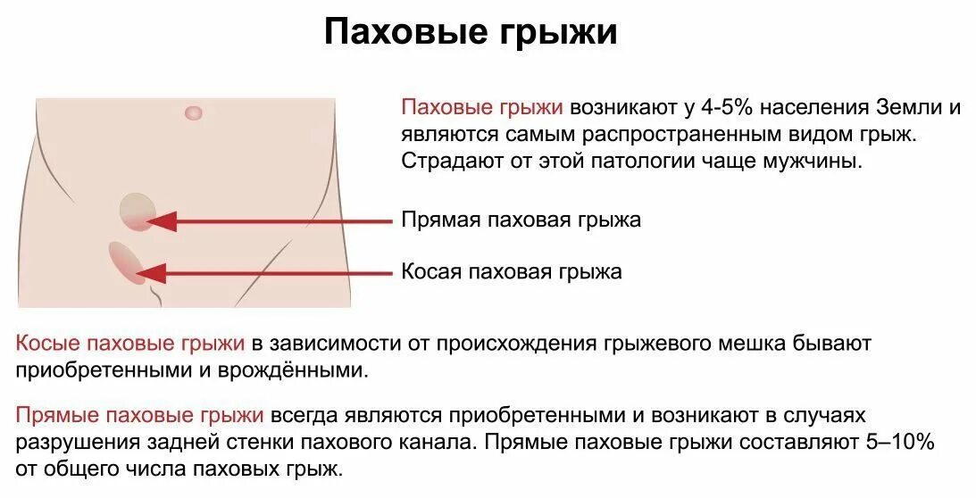 Симптомы проявления паховой грыжи. Паховая грыжа у мужчин симптомы. Симптомы паховой грыжи у мужчин. Грыжа в паховой области у женщин симптомы