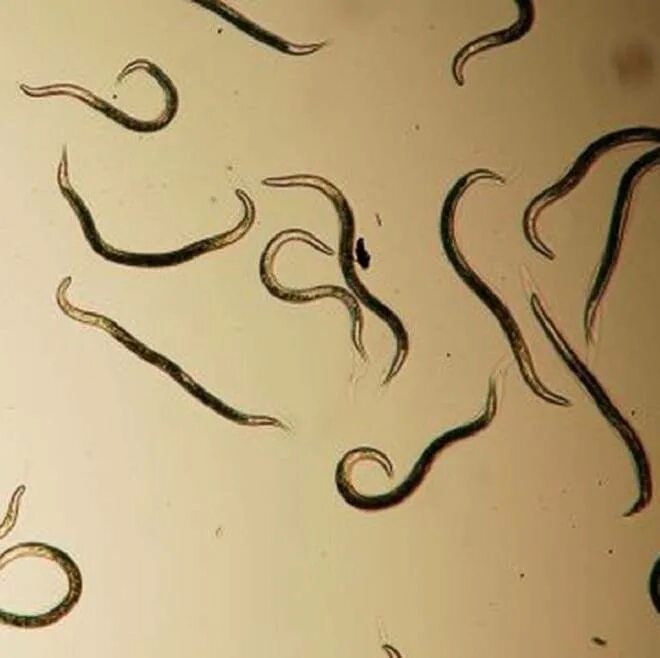 Кошачьи глисты анкилостома. Круглые гельминты у человека. Круглые черви нематоды паразиты. 7. Гельминт 0.