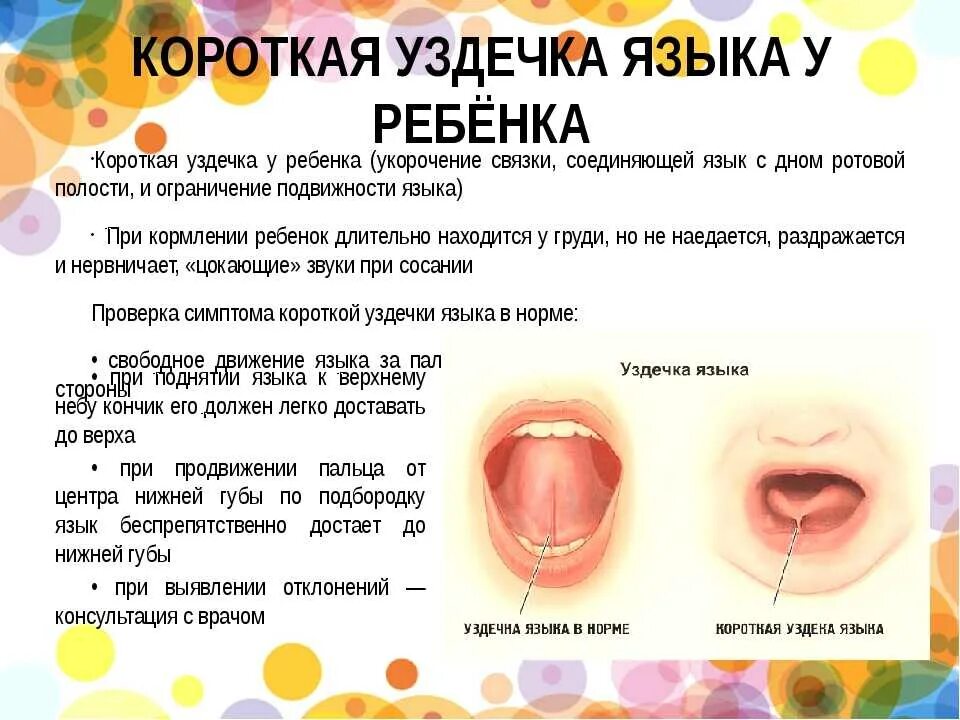 Как лечить уздечку
