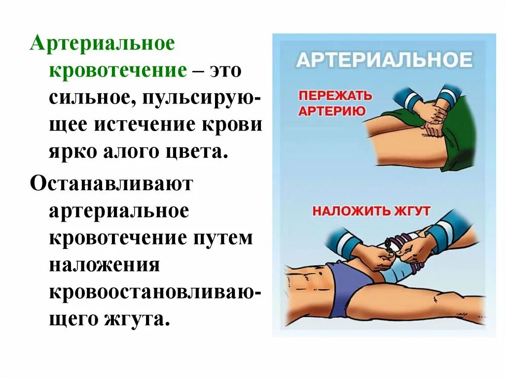 Что такое кровотечение кратко. Артериальное кровотечение. Артериаль кровотечение. Вртериальноекровотичение. Артериальноеткровотечение.