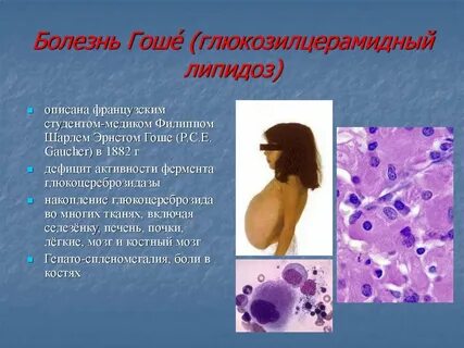 Болезнь с1