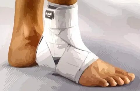 Растяжения связок голеностопа восстановление