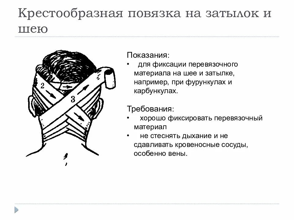 Перевязка шеи. Крестообразная повязка на затылок показания. Показания к наложению крестообразной повязки на затылок. Колосовидная повязка на затылок. Техника наложения крестообразной повязки на затылок алгоритм.