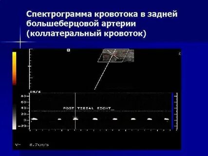 Магистральный кровоток